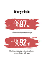 Red Peel | Canlandırıcı Ve Cilt Tonu Eşitleyici Kırmızı Peeling Serum 30ml